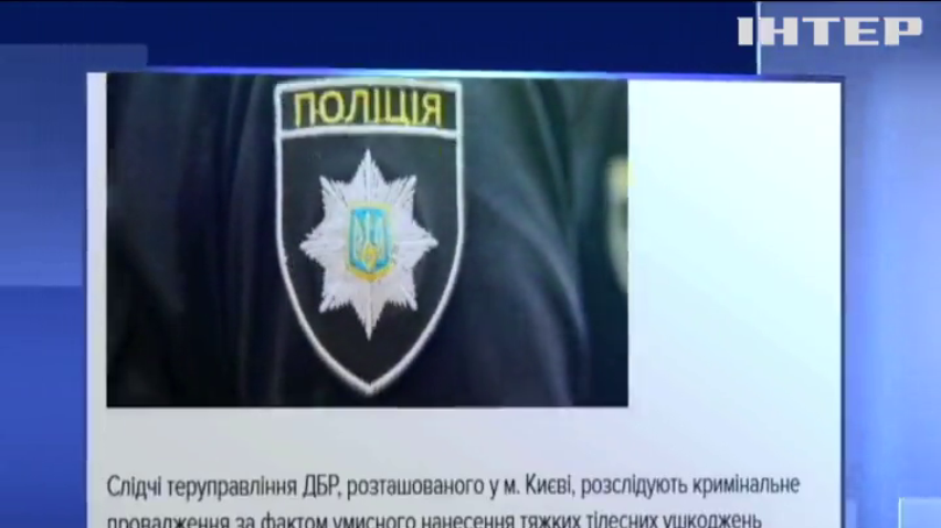 На Київщині поліцейські стріляли у п'ятирічну дитину