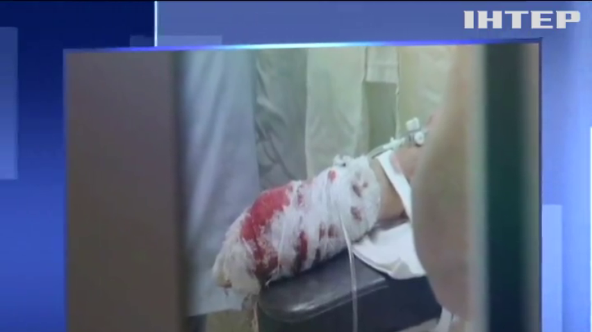 Вибух на Дніпропетровщині: діти знаходяться у тяжкому стані