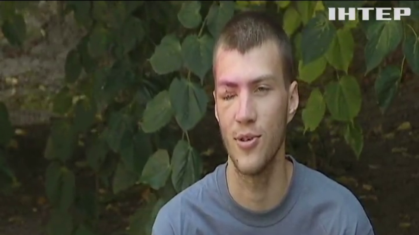 У Дніпрі рятують двох військовослужбовців з пошкодженнями очей