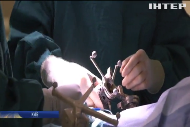 Порятунок для пацієнтів з аневризмами: український нейрохірург винайшов чудодійний пристрій