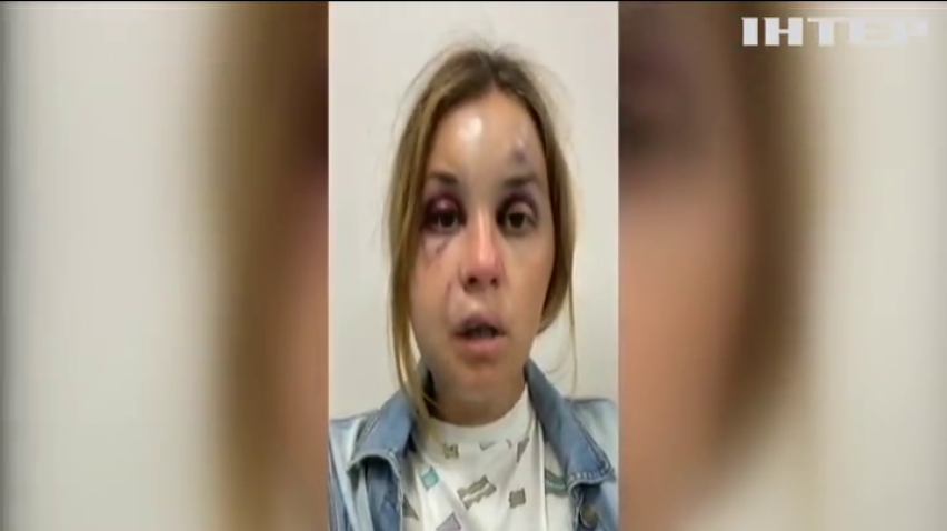 Телеведучу "Інтера" намагалися зґвалтувати у поїзді: злочинцю загрожує сім років за ґратами