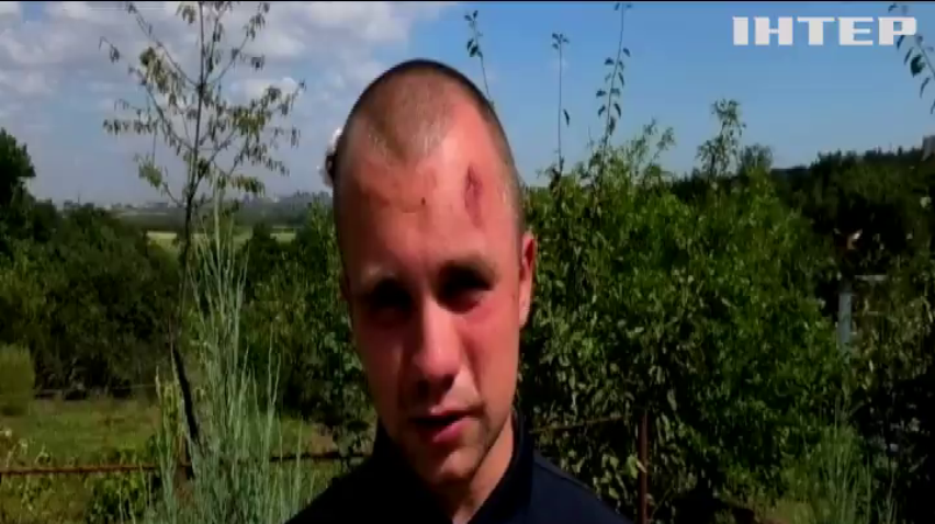 Кривавий збір підписів за проведення місцевих виборів: на Донбасі: в "Опозиційній платформі - За життя" вимагають покарати нападників