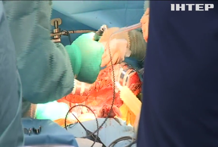 В інституті Шалімова провели унікальні операції з трансплантації органів