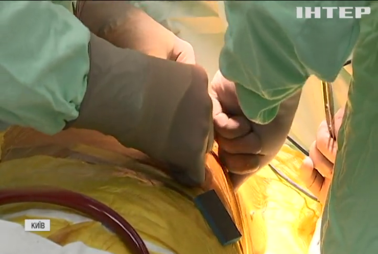 Українські кардіохірурги запровадили унікальну методику лікування серцевої хвороби