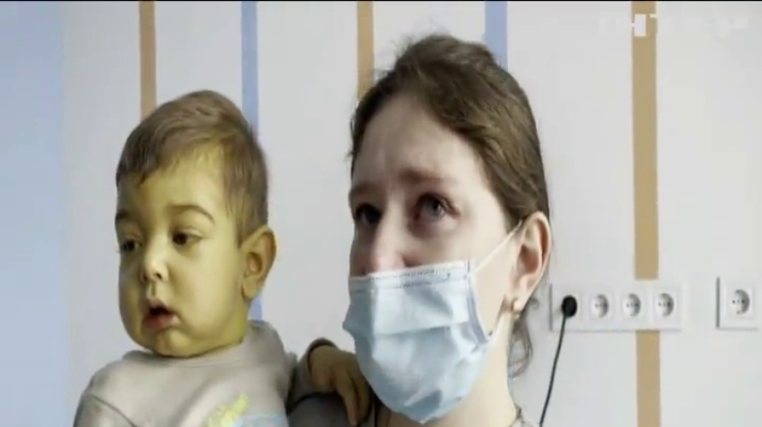 Львівські лікарі зробили найскладнішу у світі операцію