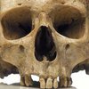 В античном захоронении в Греции обнаружены останки человека со следами трепанации черепа