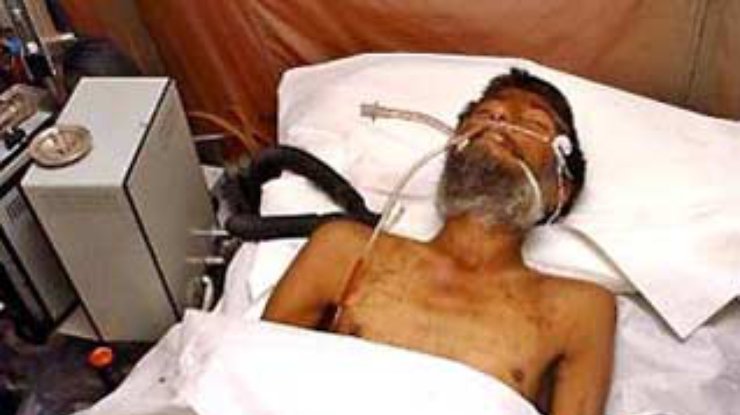 Иранец, спасенный из-за под завалов спустя две недели, скончался в госпитале