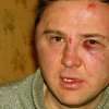 Совершено бандитское нападение на директора Kiev2000.com