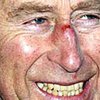 Принц Чарльз повредил нос об изгородь