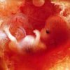 Европейский суд не смог запретить аборты