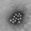 В Ивано-Франковской области 12 человек госпитализированы с вирусным гепатитом А