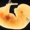 Российские ученые считают возможным клонирование двухнедельных эмбрионов человека