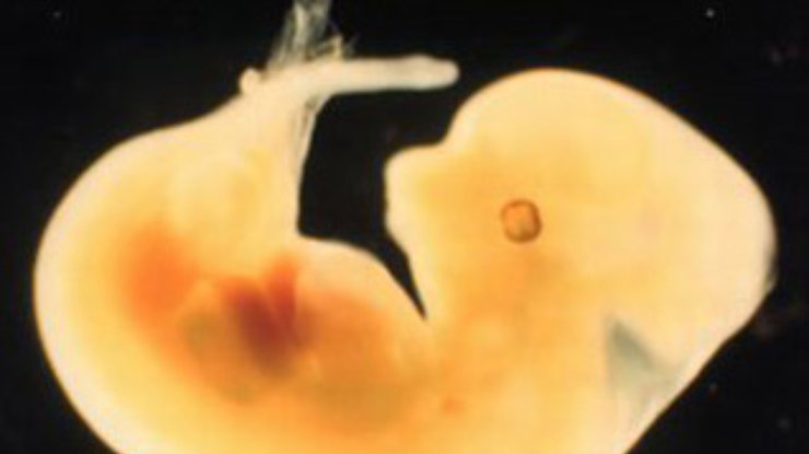 Российские ученые считают возможным клонирование двухнедельных эмбрионов человека