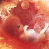 Американским врачам разрешили отказывать в аборте без объяснения причин