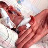 В США родился самый маленький ребенок на Земле