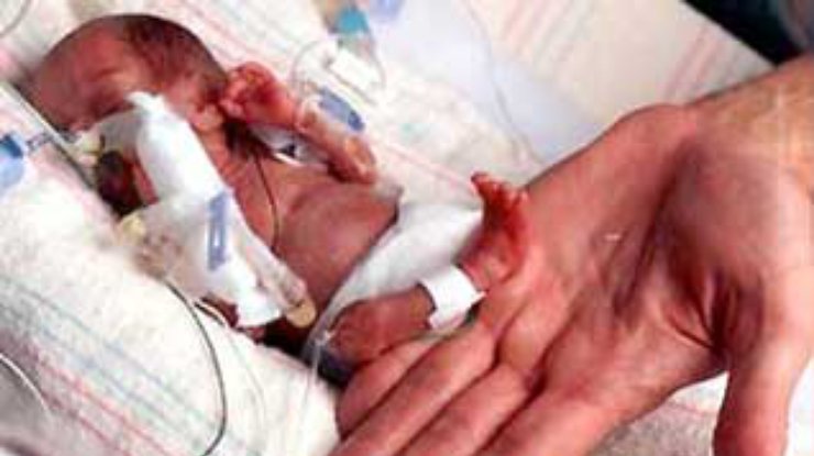 В США родился самый маленький ребенок на Земле