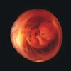 Observer: Украина торгует эмбрионами
