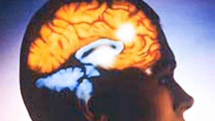 Ученые выяснили, что любовь делает с мозгом человека