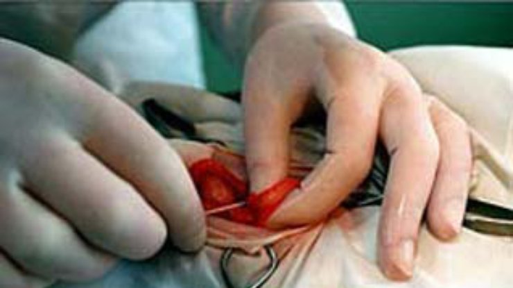 В Малайзии проведена операция по вживлению искусственного сердца