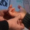 Белорусские медики учатся ставить диагнозы по ладоням