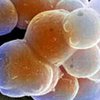 Из эмбриональных стволовых клеток выращена хрящевая ткань