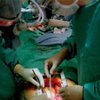 Трансплантация made in China губит японцев
