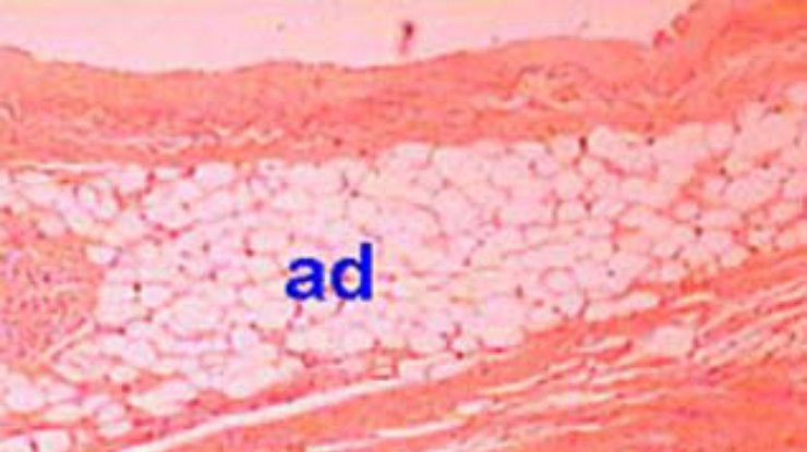 Болезни сердца связаны с деятельностью жировых клеток эпикарда