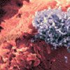 Раскрыт механизм развития Т-клеточного лейкоза