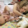 В США второй день идет операция по разделению сиамских близнецов