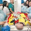 В Китае выписана из больницы одна из разделенных в июле сиамских сестер-близнецов