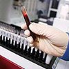 Американцев поголовно проверят на ВИЧ
