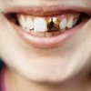 Чиновникам из Таджикистана запретили носить золотые зубы