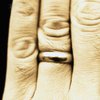 В честь развода австриец отрезал себе палец
