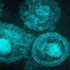 Вирус иммунодефицита прячется  в яичках