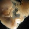 Генпрокуратура разобралась с делом об эмбрионах