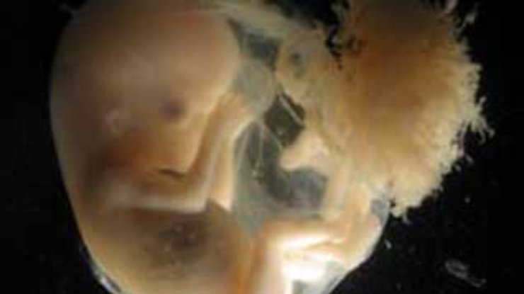 Генпрокуратура разобралась с делом об эмбрионах