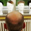 Лысым дали надежду