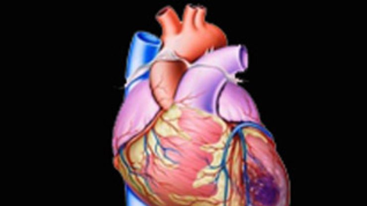 Пластырь восстановит сердечную мышцу после инфаркта