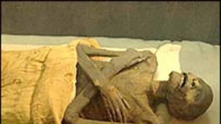 Древняя мумия поможет побороть вирус гепатита В