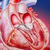 Лечение болезней сердца должно зависить от пола пациента
