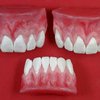 Отсутствие зубов влияет на развитие слабоумия