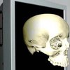 3D-дисплей для хирургов