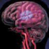 В развитии мигрени "виноват" гипоталамус?