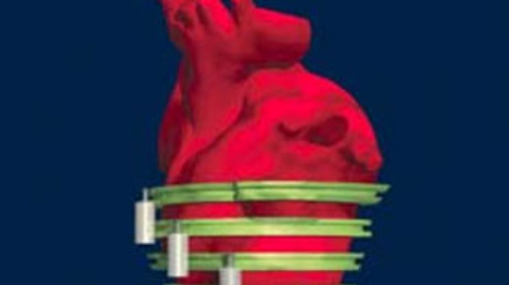 Британские ученые изобрели имплантант для сердца