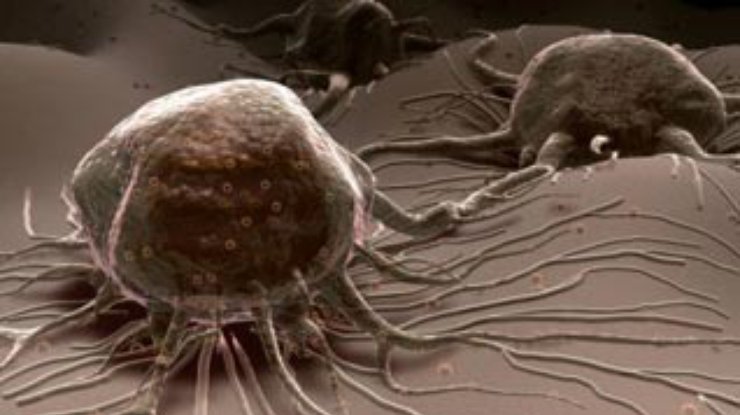 Биологи выявили закономерности развития раковых опухолей