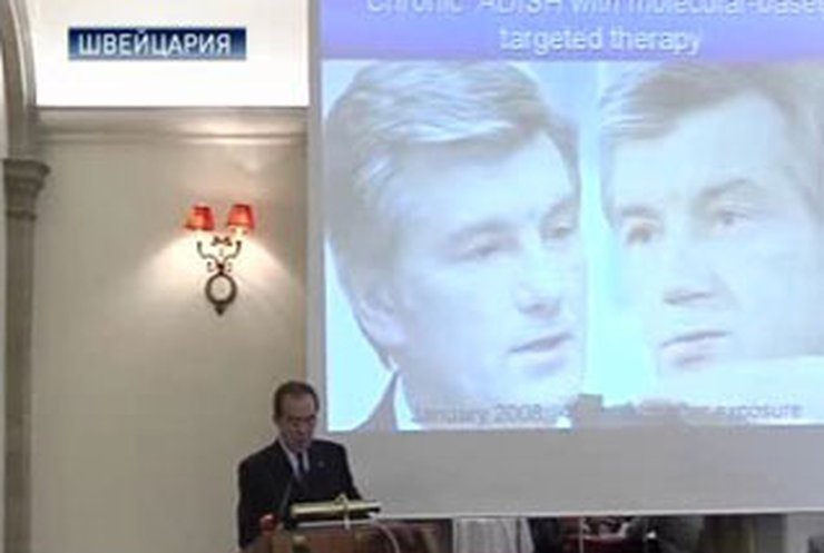 Международная группа врачей: Ющенко был отравлен