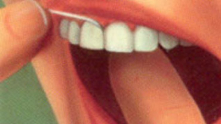 Зубная нить поможет сохранить жизнь зубов