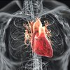 7 потенциальных причин инфаркта