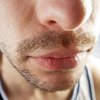 Медики: В носу человека найдена опасная бактерия