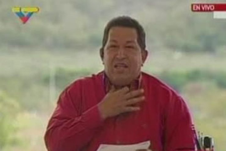 Доктора посоветовали Уго Чавесу помолчать